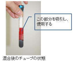 この部分を吸引し、使用する